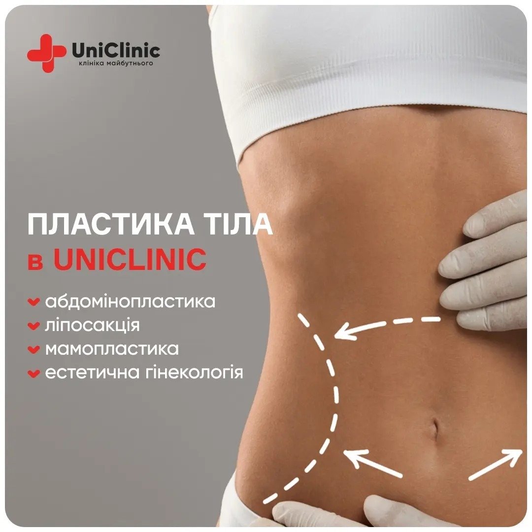 tarhetovana-reklama-keys-uniclinic